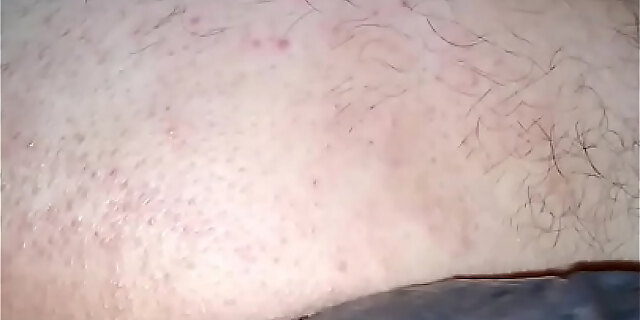 anus