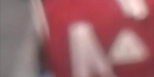 anal,ass